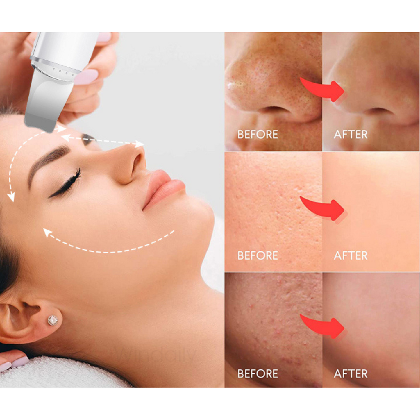 Ultrasonic SkinClean Pro