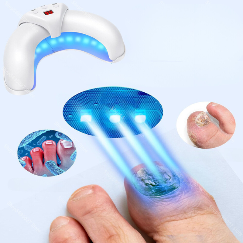 NailThera Pro – Lichttherapie-Lampe für gesunde Nägel und schmerzfreie Füße