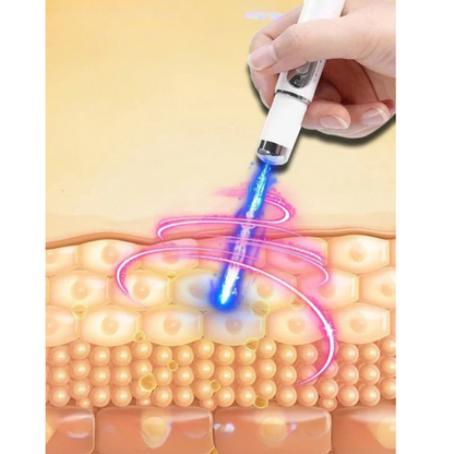 SkinRenew – Laser-Therapiegerät für Hautregeneration und Narbenreduktion