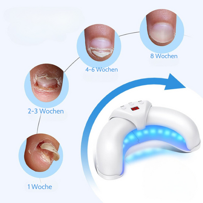 NailThera Pro – Lichttherapie-Lampe für gesunde Nägel und schmerzfreie Füße